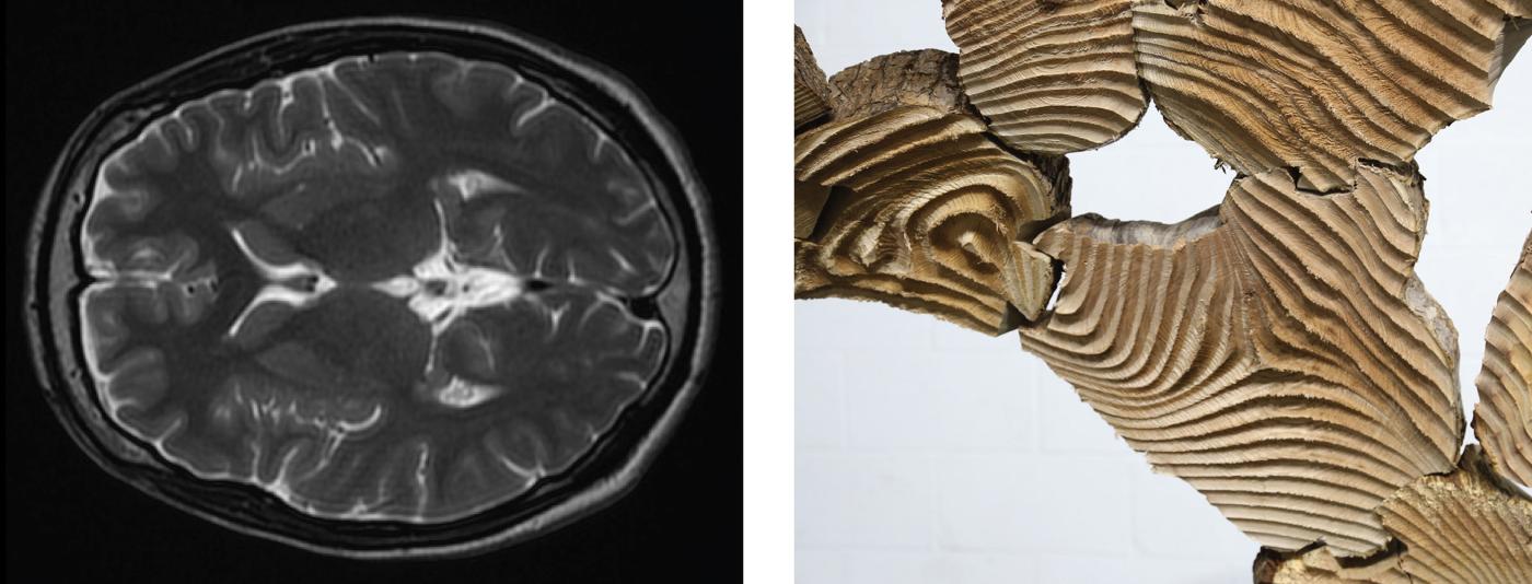 Image of Brain Scan and Biomaterial Assembly